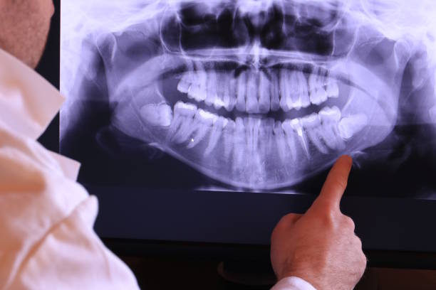 Best Urgent Dental Care for Toothaches in Lone Tree, IA
