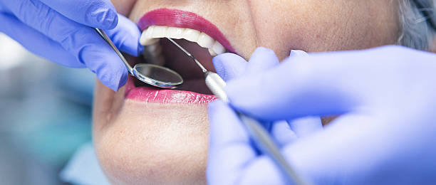 Best Emergency Treatment for Oral Infections in Lone Tree, IA